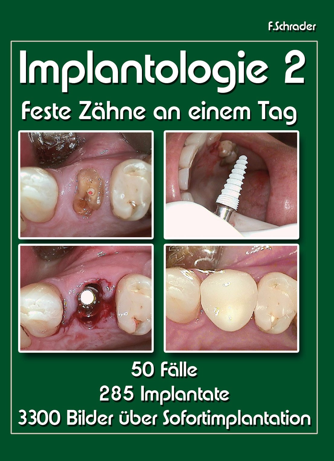 Implantologie2